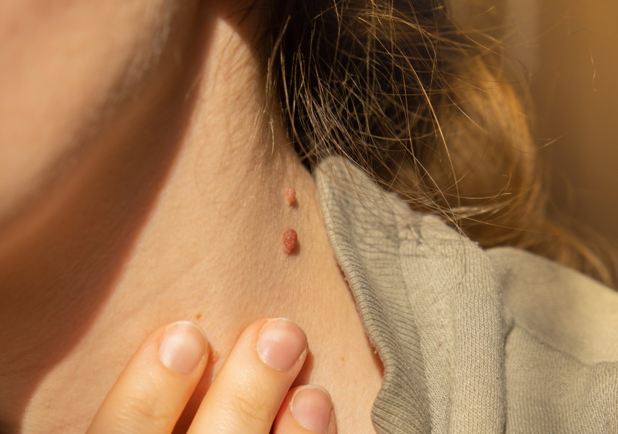 Špatná diagnóza kvůli příliš hezké fotce z mobilu