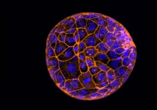 Barevně upravený mikroskopický snímek lidského embrya ještě v podobě shluku buněk.