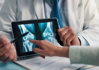 Osteoporóza se rozvíjí nenápadně, ale její následky mohou být zásadní