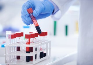 Rakovina zjištěná z kapky krve: pardubická firma chce do praxe přivést nápad českého vědce