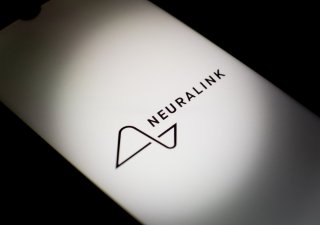 Muskova firma Neuralink implantovala mozkový čip prvnímu člověku