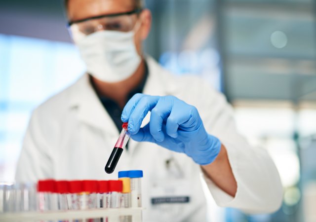 Čuprův start-up Macromo začal testovat krev s pomocí umělé inteligence