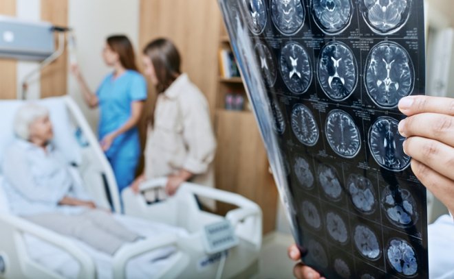 Alzheimer je v Česku málu. Klienti přibývají výrazně rychleji než počet lůžek.