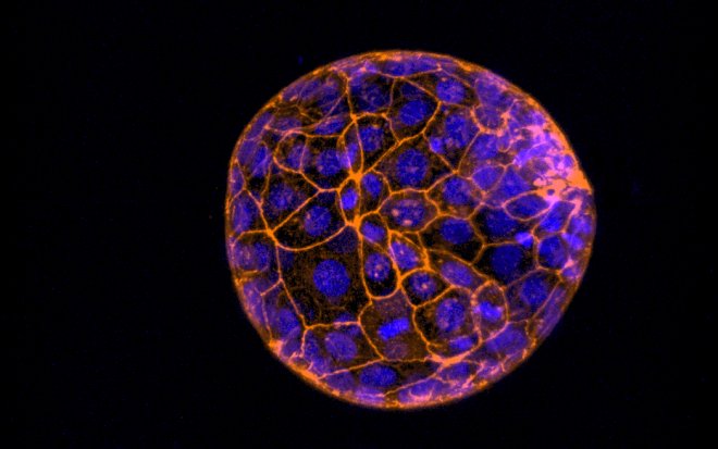 Barevně upravený mikroskopický snímek lidského embrya ještě v podobě shluku buněk.