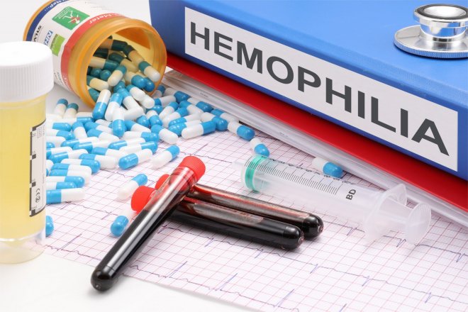 Hemofilie - ilustrační foto