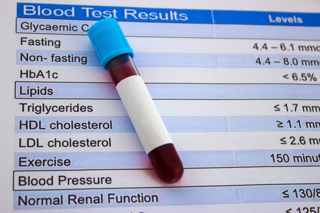 Nová zbraň proti cholesterolu láká investory. Biotech podporovaný Eli Lilly jde na burzu