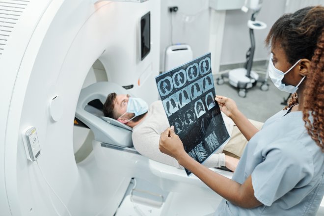 MRI scan, mozek, magnetická rezonance