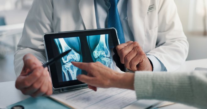 Osteoporóza se rozvíjí nenápadně, ale její následky mohou být zásadní