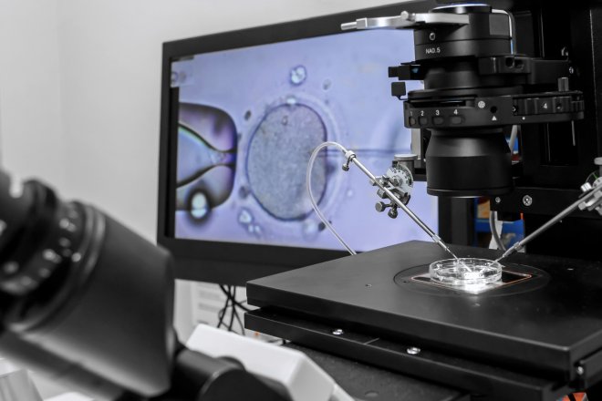 Vědci hledají šetrnější cestu k početí. Spermie zkoušejí navádět magnetem