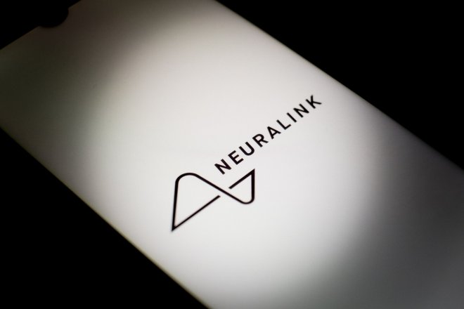 Muskova firma Neuralink implantovala mozkový čip prvnímu člověku