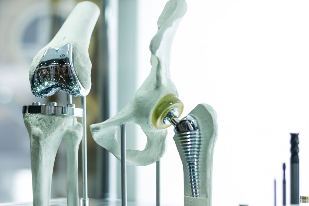 Náhrady kostí a kostních kloubů vyrobené pacientovi přesně na míru na 3D tiskárně.