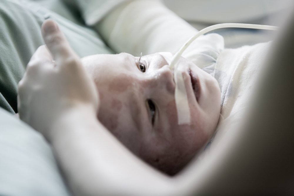 KAŽDODENNÍ ŽIVOT: Jarmila Štuková, volná fotografka / Operace 18 měsíční Yulie z Ukrajiny